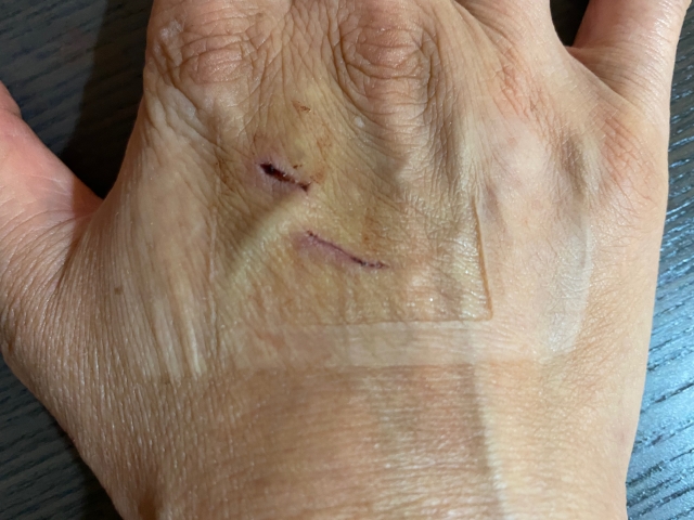 イメージ：引っ掻き傷