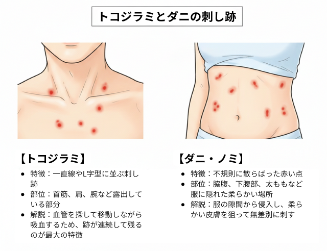 トコジラミとダニの刺し跡